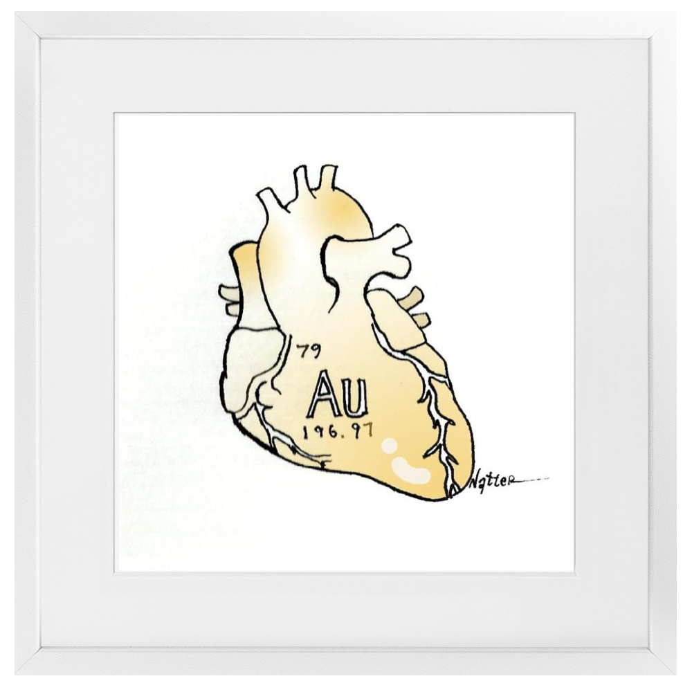 Heart of Gold Framed Print