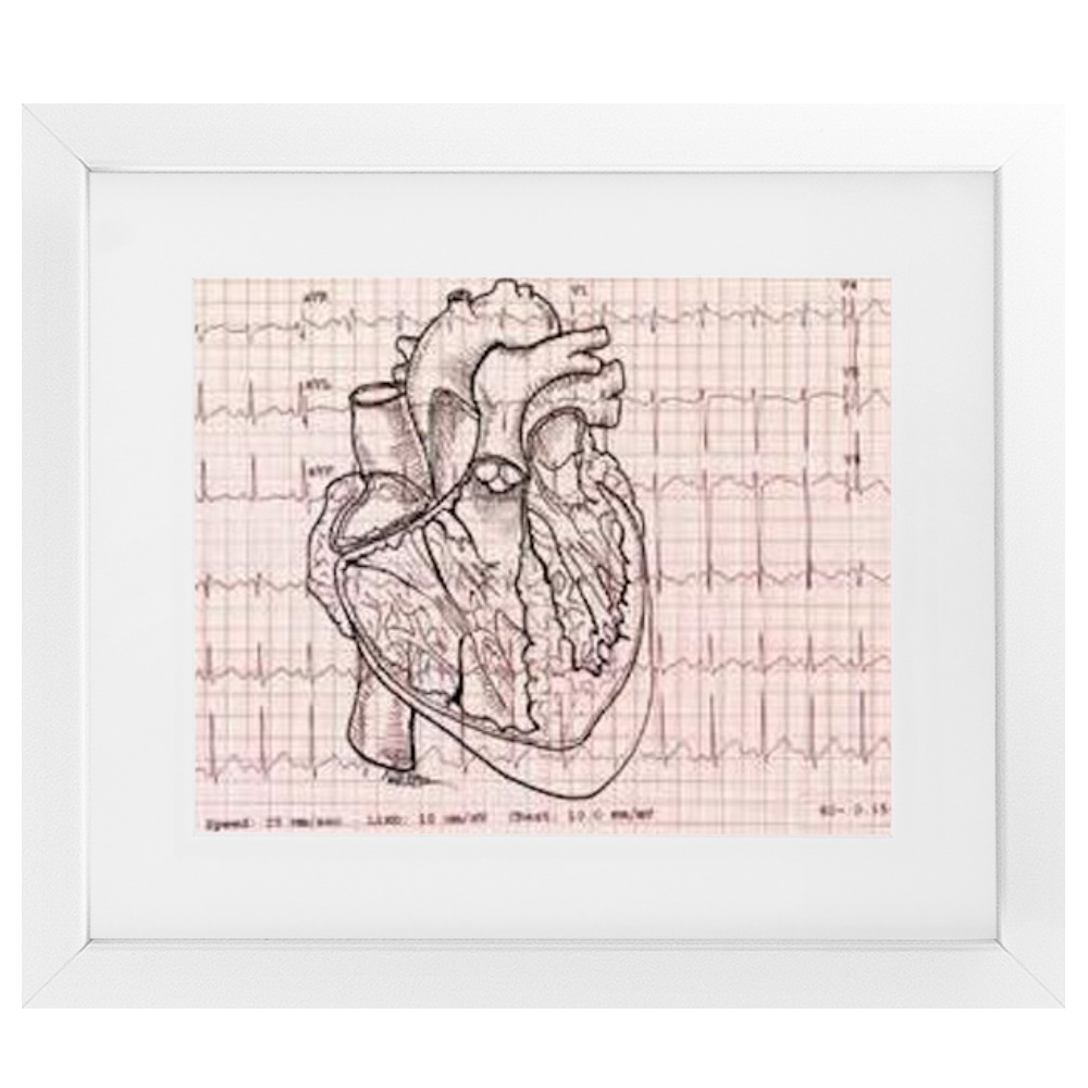 EKG Heart Framed Print