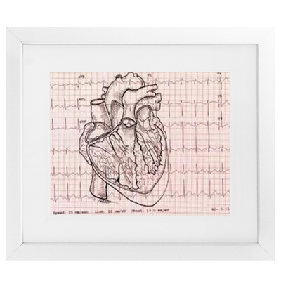 EKG Heart Framed Print
