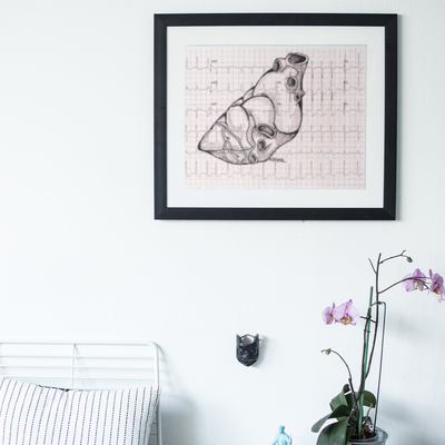 EKG Framed Print