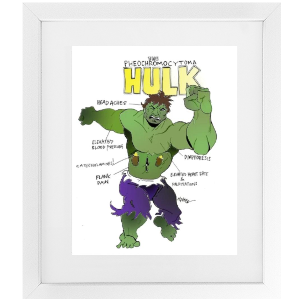 Pheochromocytoma Hulk Framed Print