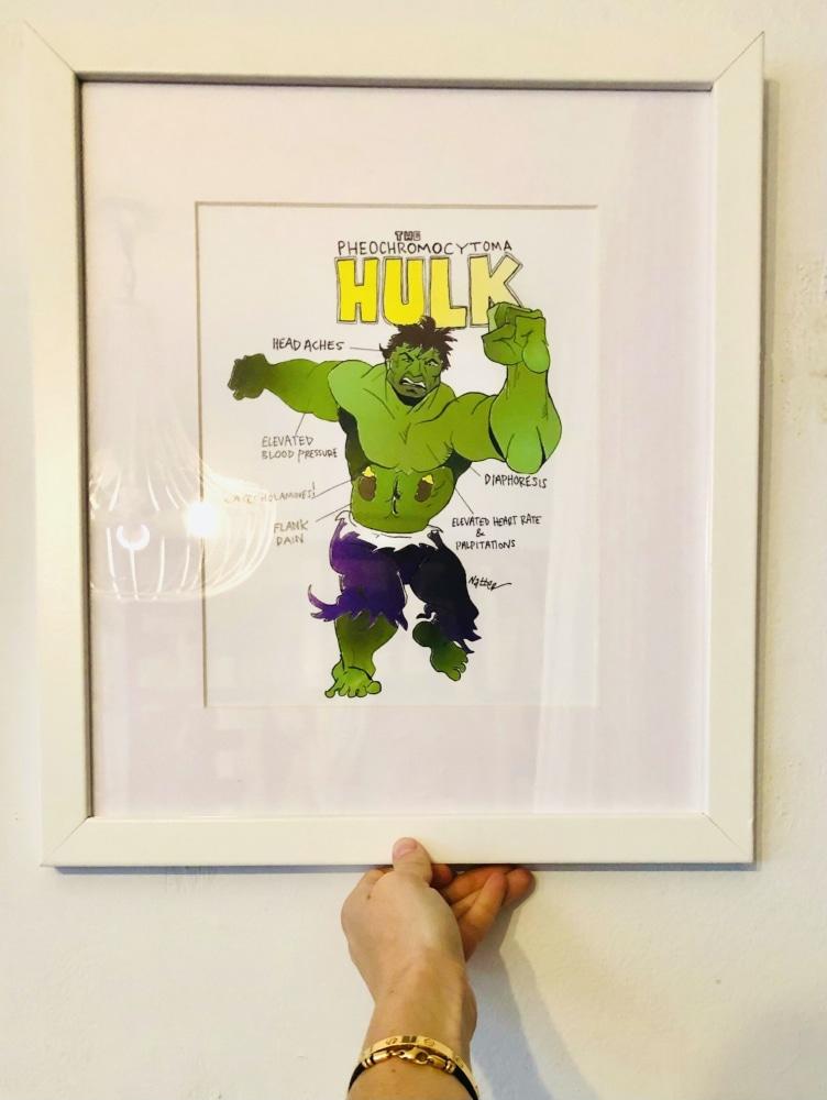 Pheochromocytoma Hulk - Framed Print